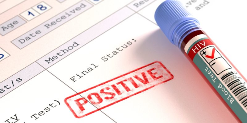 حوالي21 ألف شخص في المغرب حامل لفيروس نقص المناعة البشرية HIV/AIDS