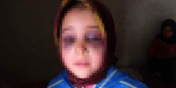 استئنافية أكادير تؤجل النطق بالحكم في حق الأستاذ المتهم بتعنيف تلميذته بعدما صرَّحت هذه الأخيرة بتعرضها للتعنيف من طرف والدتها