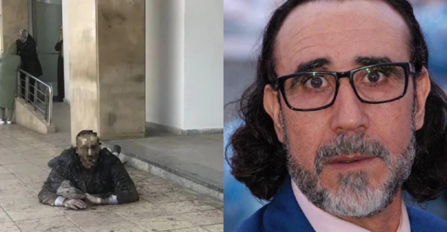وفاة الفنان المسرحي أحمد جواد الذي أضرم النار في جسده أمام مقر وزارة الثقافة