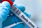 فرنسا تسجل أول إصابة مؤكدة بفيروس إيبولا