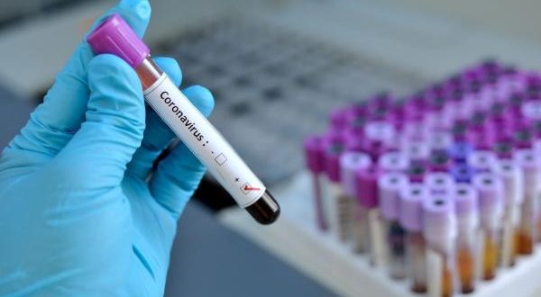 في ظرف 16 ساعة المغرب يسجل 245 حالة إصابة مؤكدة بفيروس كورونا