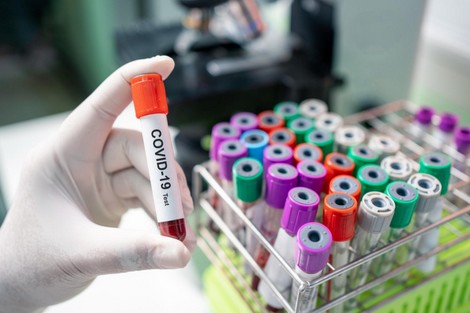 المغرب.. تسجيل 2234 حالة إصابة جديدة ب(كوفيد- 19) و32 حالة وفاة خلال الـ24 ساعة الأخيرة