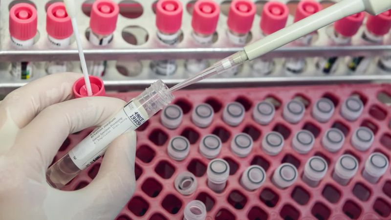 كورونا.. المغرب في المركز الثاني إفريقيا والأول في شمال إفريقيا من حيث عدد تحاليل الكشف عن الفيروس