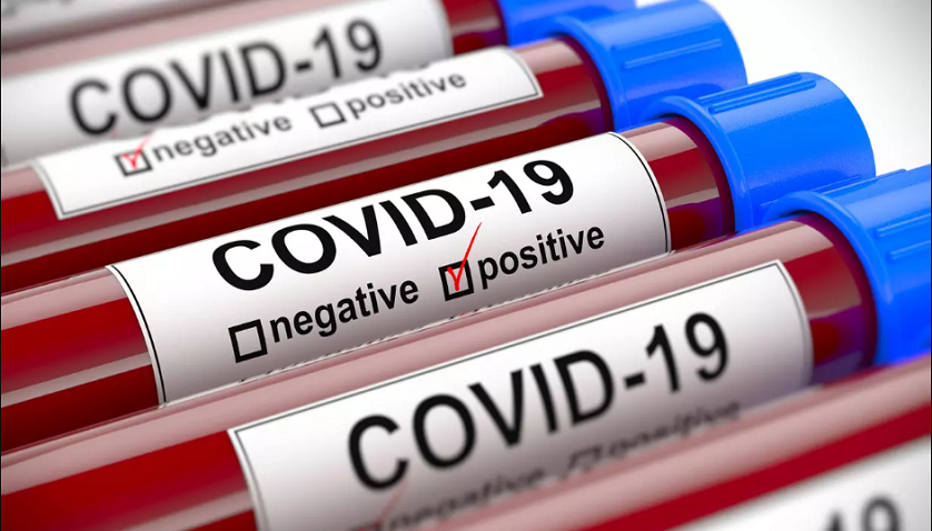 فيروس كورونا.. 243 إصابة و87 حالات شفاء بالمغرب خلال ال24 ساعة الماضية