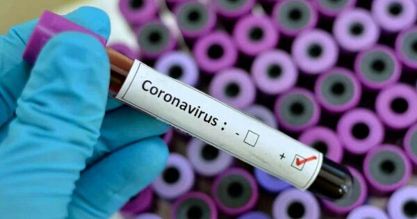 (كوفيد-19).. 1343 إصابة جديدة و 33 حالة وفاة بالمغرب خلال الـ24 ساعة الأخيرة