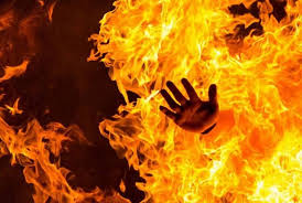 سيدي سليمان.. شخص يضرم النار بدم بارد في جسد ابنته القاصر