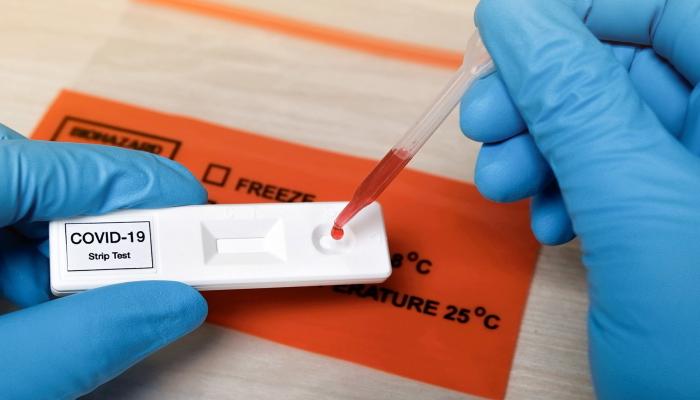 أيهما الأفضل.. خبير يكشف الفرق بين الـ PCR والاختبارات السريعة للكشف عن 