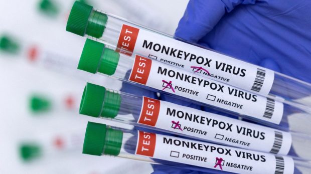 رصد 13 مخالطا للمصاب بجدري القردة في المغرب (مسؤول بوزارة الصحة والحماية الإجتماعية)