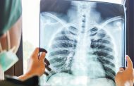 اليوم العالمي لمحاربة داء السل.. محطة لإبراز جهود المغرب في مكافحة هذا المرض
